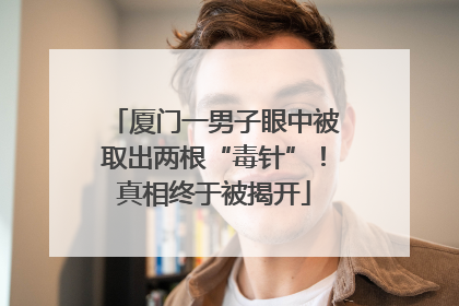 厦门一男子眼中被取出两根“毒针”！真相终于被揭开